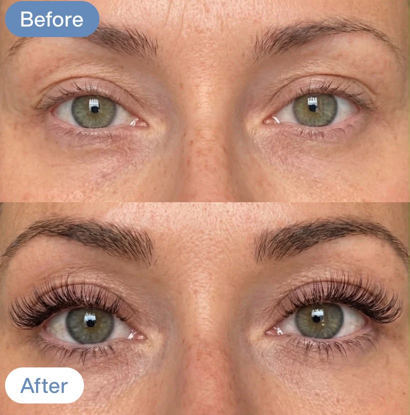Before & after (stacked)